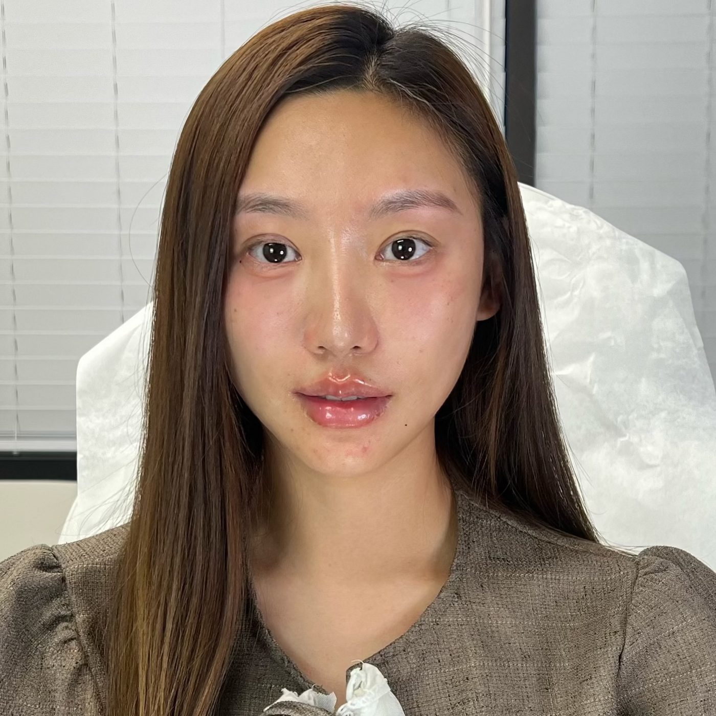 After